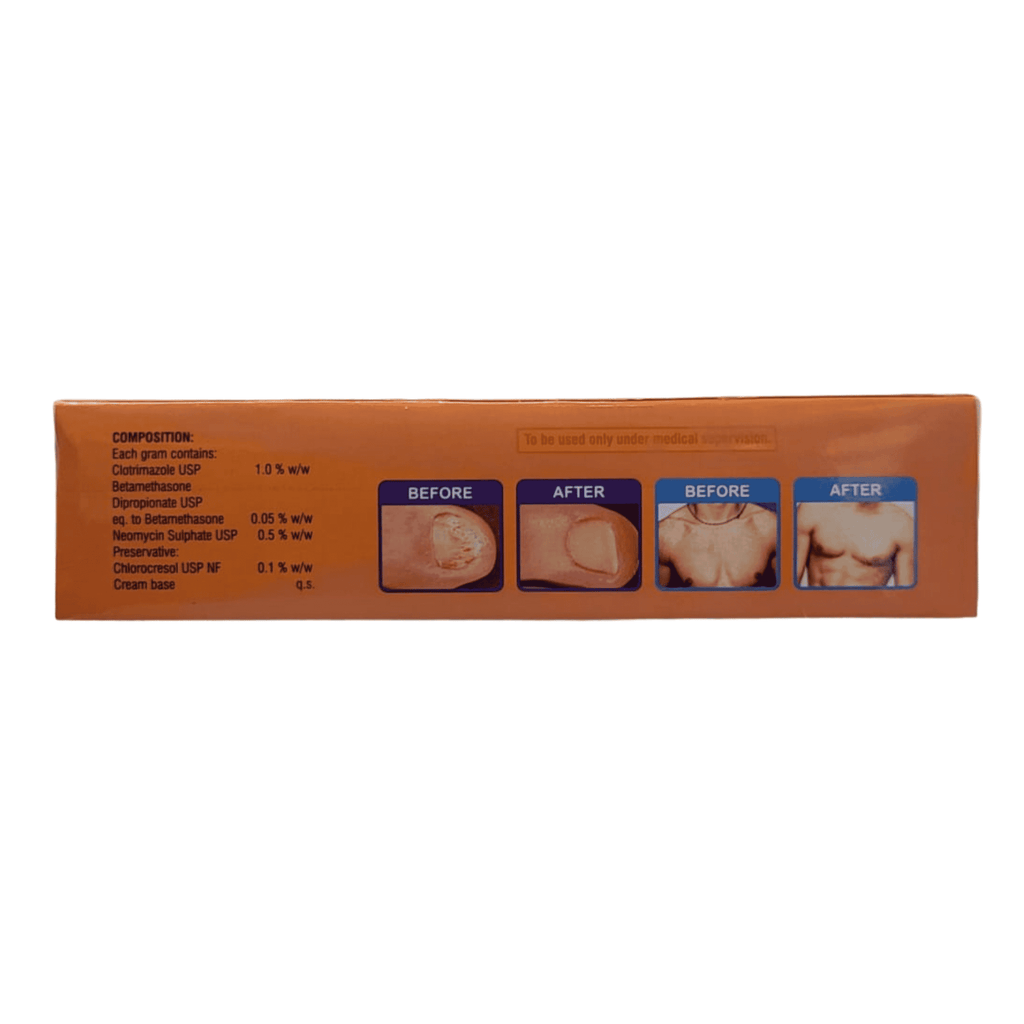 Philobact Product packaging with 'Before' and 'After' images on a white background
